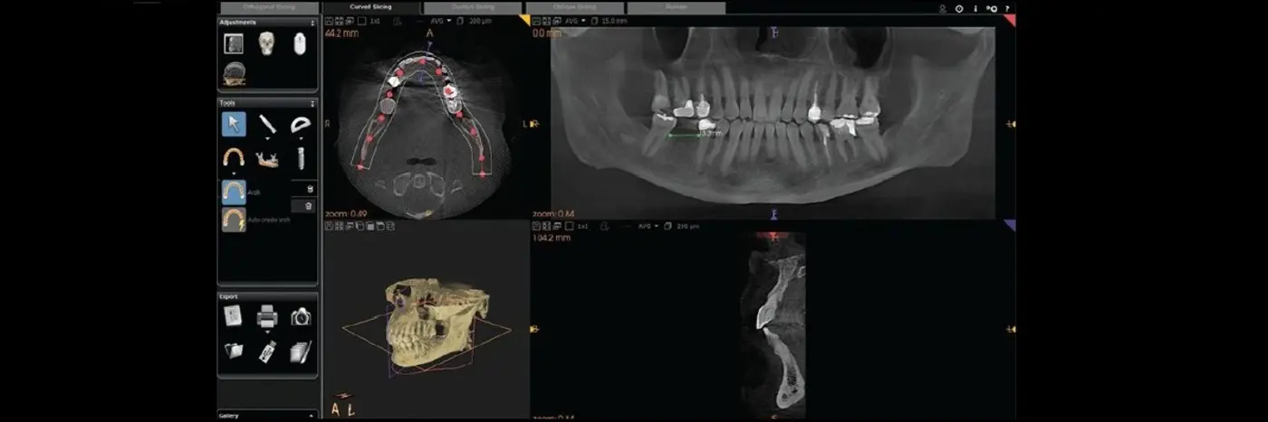 cbct görüntüsü