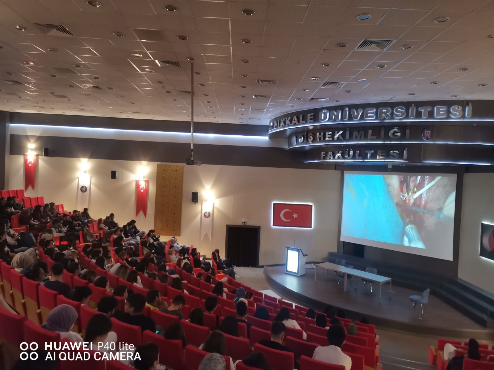 FAKÜLTEMİZ ŞEHİT AHMET ÖZSOY KONFERANS SALONUNDA AĞIZ DİŞ ve ÇENE CERRAHİSİ BÖLÜMÜ TARAFINDAN DÖRDÜNCÜSÜ GERÇEKLEŞTİRİLEN CANLI CERRAHİ ÖĞRENCİLERİMİZE İZLETİLDİ. 17/04/2026
