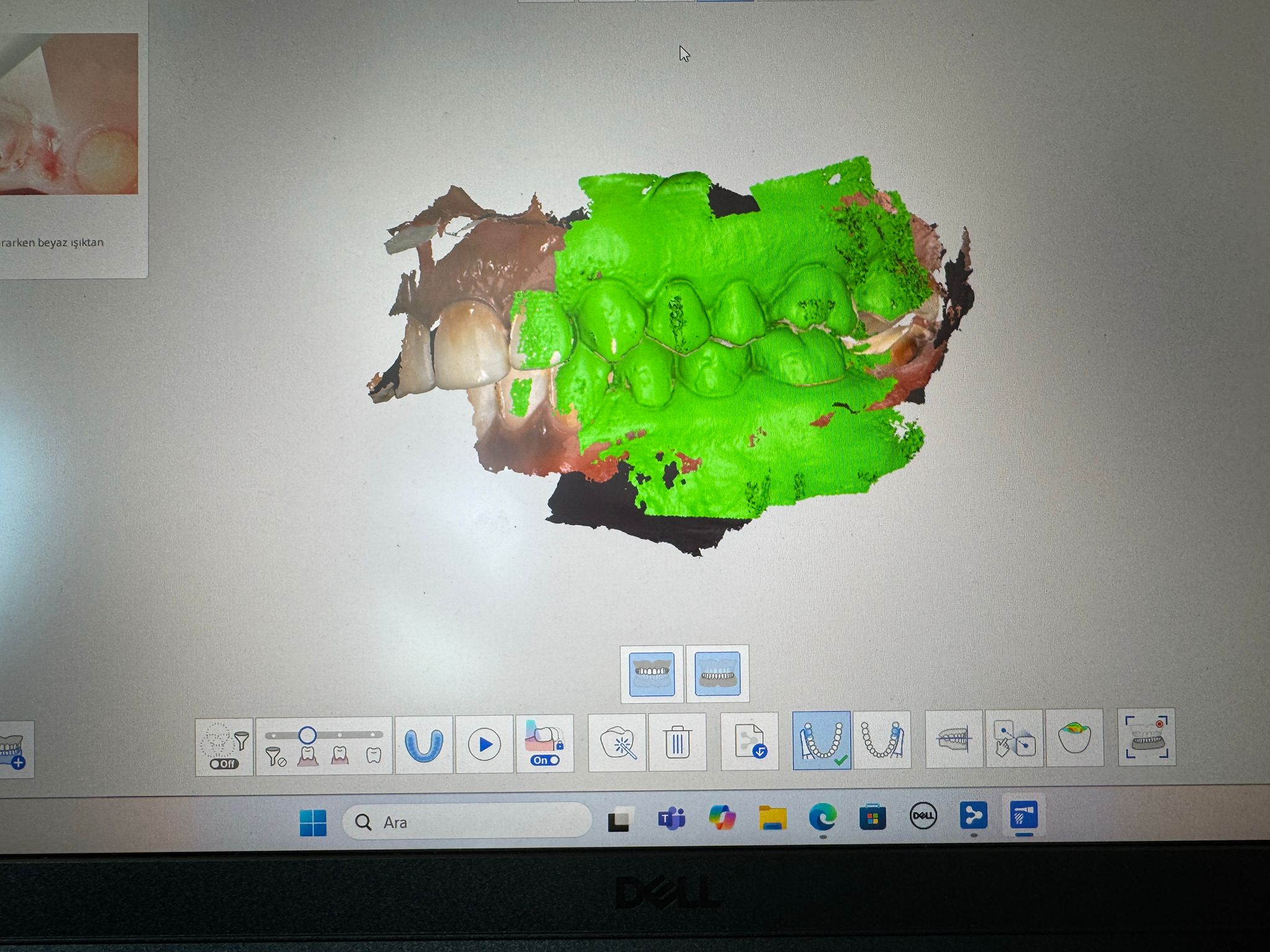 Protetik Diş Tedavisi Anabilim Dalı