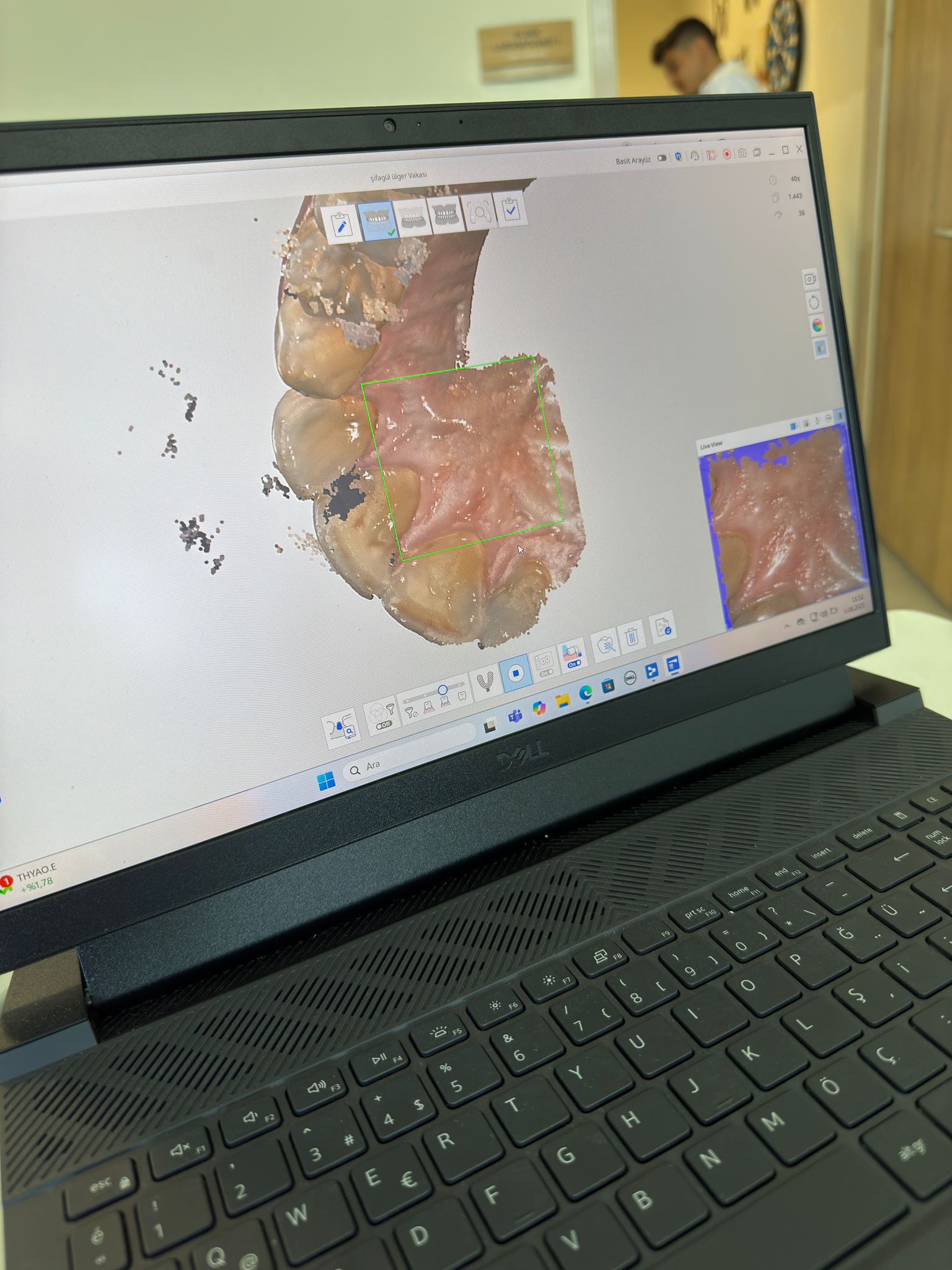 Protetik Diş Tedavisi Anabilim Dalı