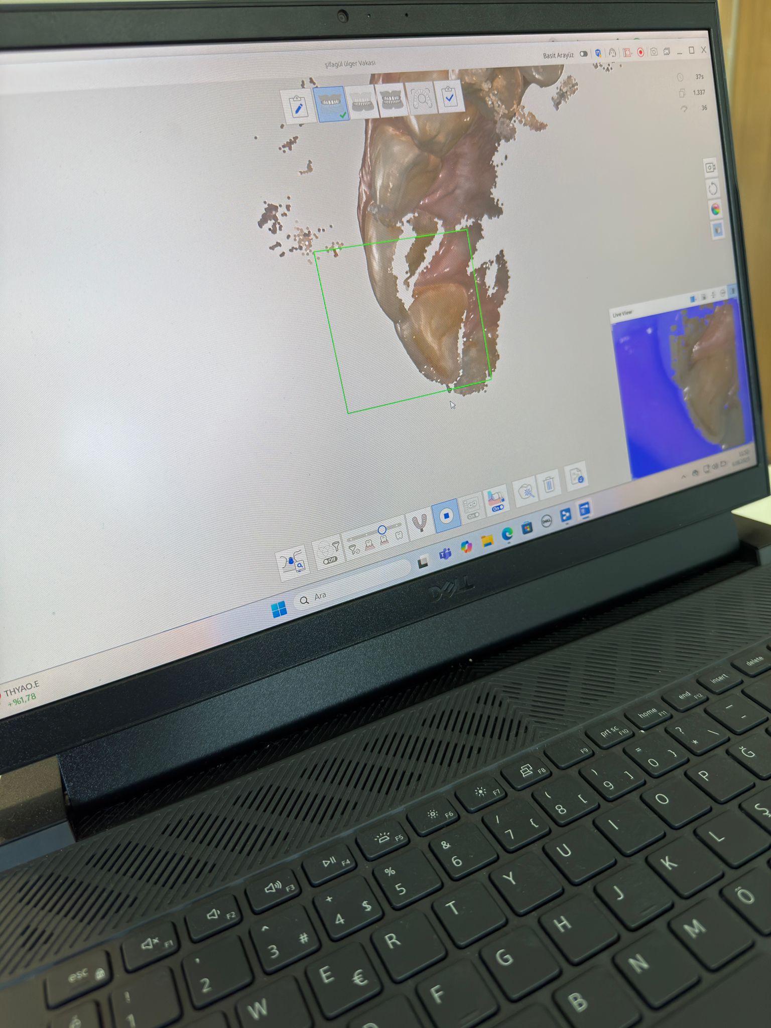 Protetik Diş Tedavisi Anabilim Dalı